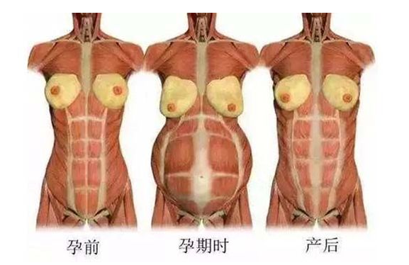 產(chǎn)后媽媽骨盆修復――帶你回到完美身材！