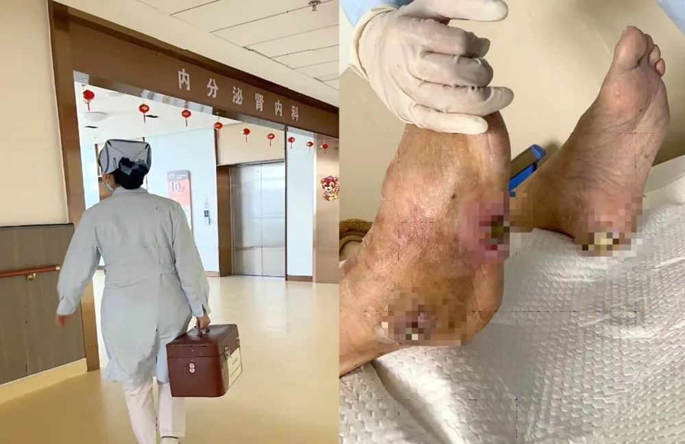 【保山安利醫(yī)院】傷口治療一站式，健康生活零距離！